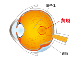 黄斑のイラスト