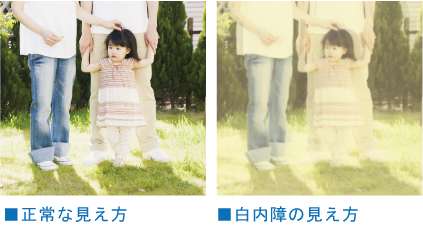 正常な見え方と白内障の見え方の違い